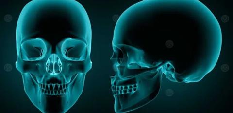 ما هي أنواع عظام الجمجمة؟