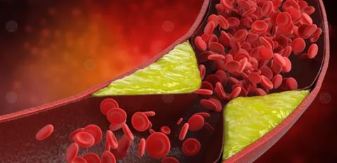 جدول نسب الكوليسترول في الدم