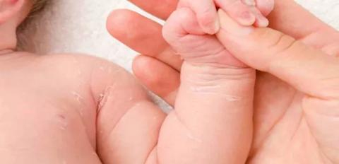 تقشر جلد الرضيع مشكلة تقلق الكثير من الامهات