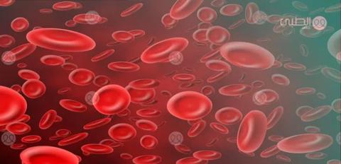 6 أسباب لفقر الدم عند النساء