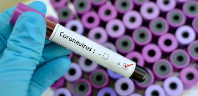 اسم جديد لفيروس كورونا من منظمة الصحة العالمية