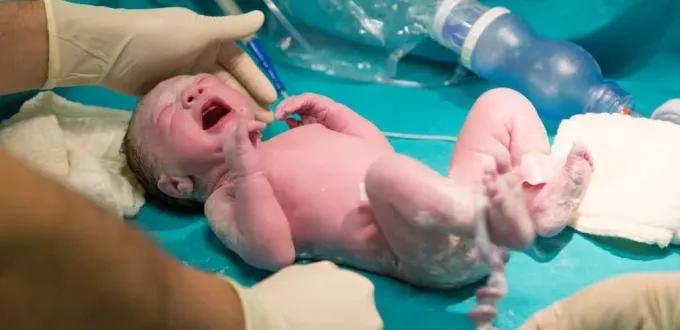 10 نصائح بعد الولادة القيصرية