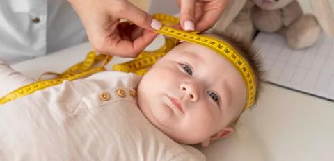 10 أسباب لصغر رأس الطفل