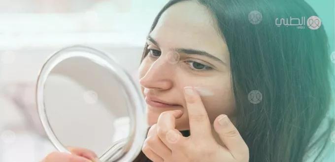 أدوية علاج الرؤوس البيضاء في الوجه والجسم