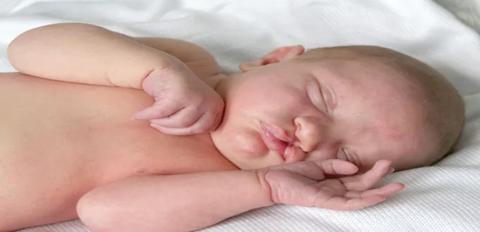 التشوهات الولادية: انواعها وكيف يمكن الوقاية